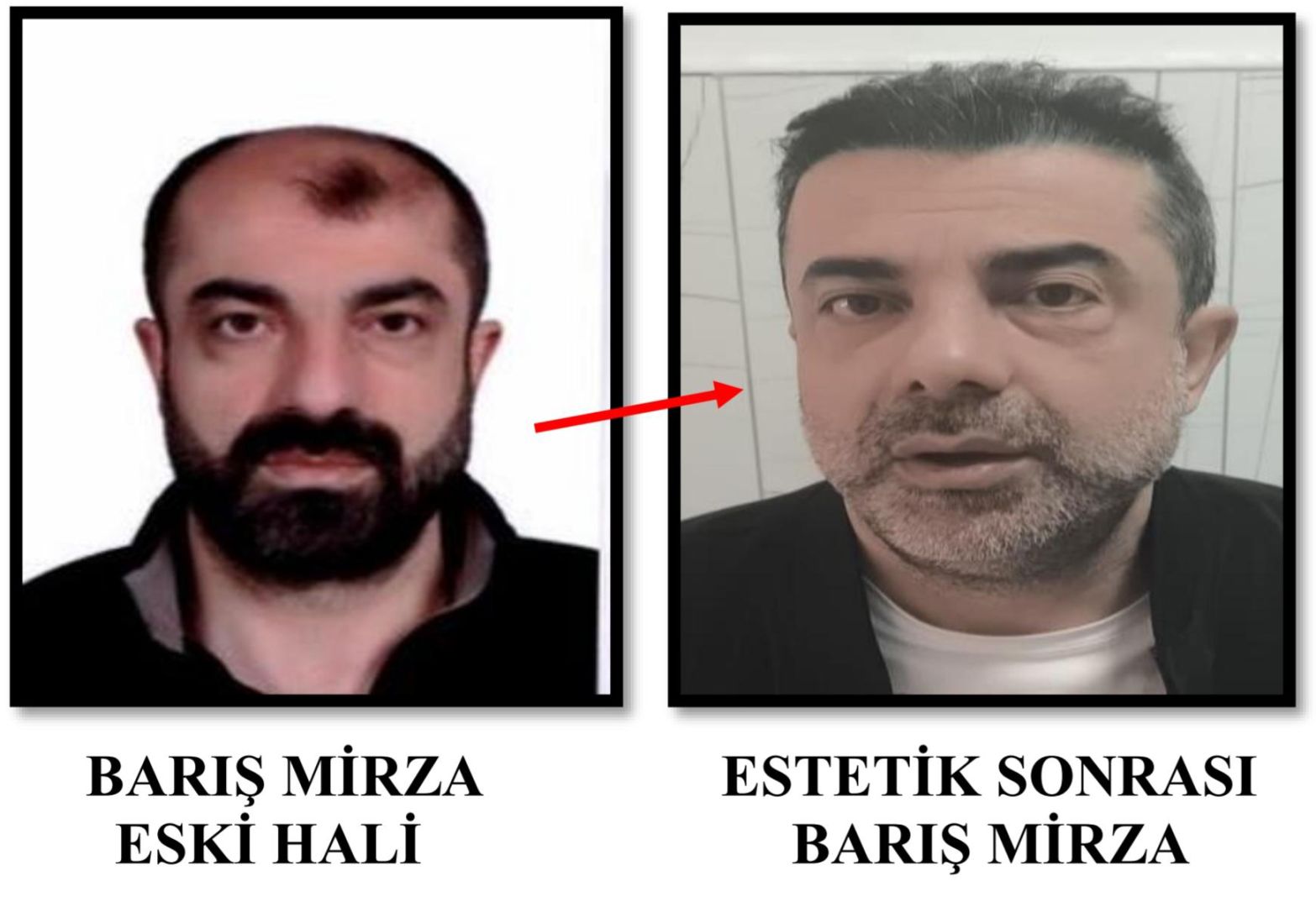 AMELİYATLA GÖRÜNÜŞÜNÜ DEĞİŞTİRDİ YİNE DE TUTUKLANDI